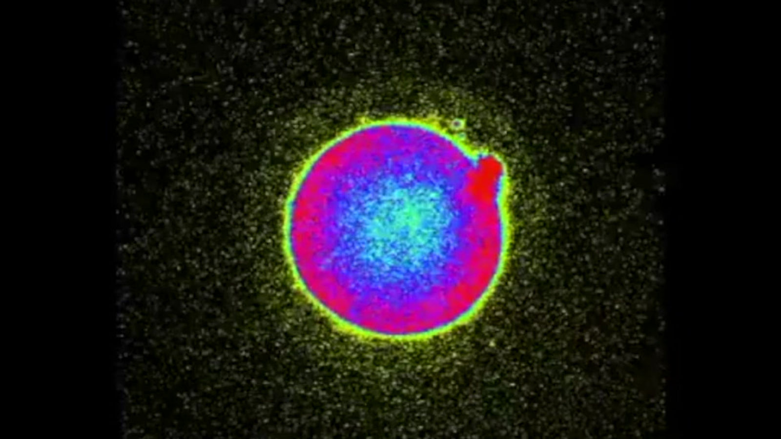Zinc "Fireworks" Radiate At The Onset Of Human Fertilization (Zoom Version)
